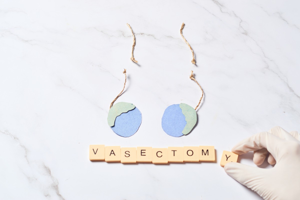 vasectomie